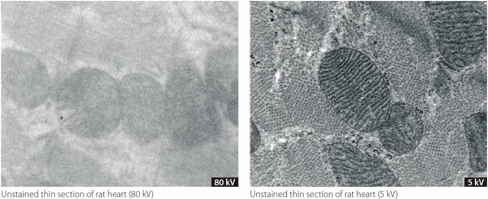 生物切片的傳統透射電鏡圖像與LVEM圖像