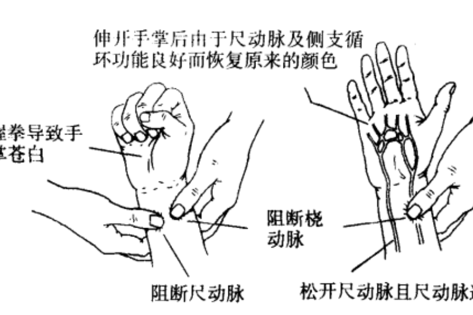 艾倫試驗 艾倫試驗