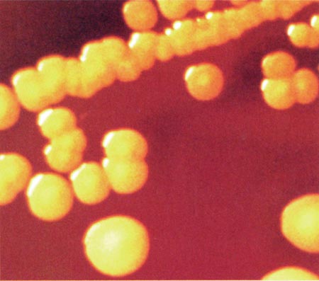 金黃色葡萄球菌