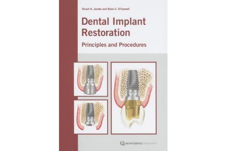 Dental Implant Restoration Dental Implant Restoration