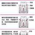 戰壕口炎 戰壕口炎