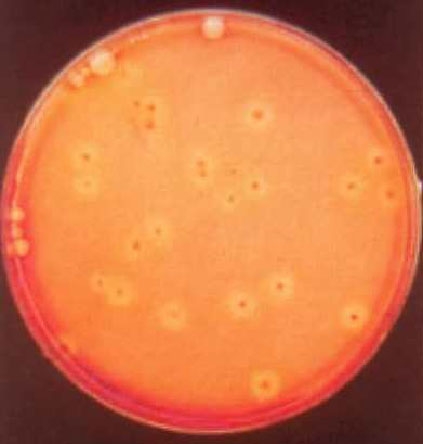 葡萄球菌A蛋白