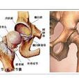 骨瓣 骨瓣