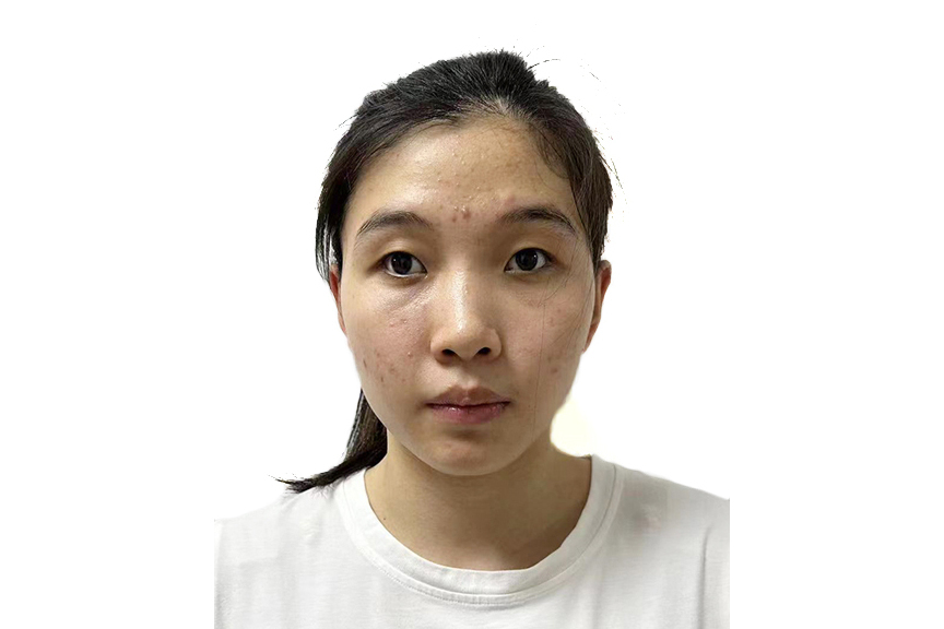 王欣怡(中國殘疾人游泳運動員) 王欣怡(中國殘疾人游泳運動員)