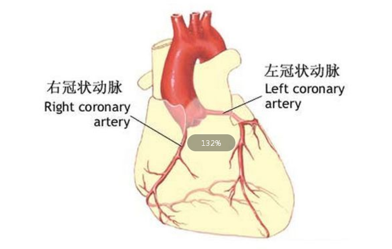 冠狀動脈心腔瘺