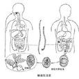 肺蛔蟲蚴移行症