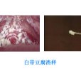 豆腐渣樣白帶(豆渣樣白帶) 豆腐渣樣白帶(豆渣樣白帶)