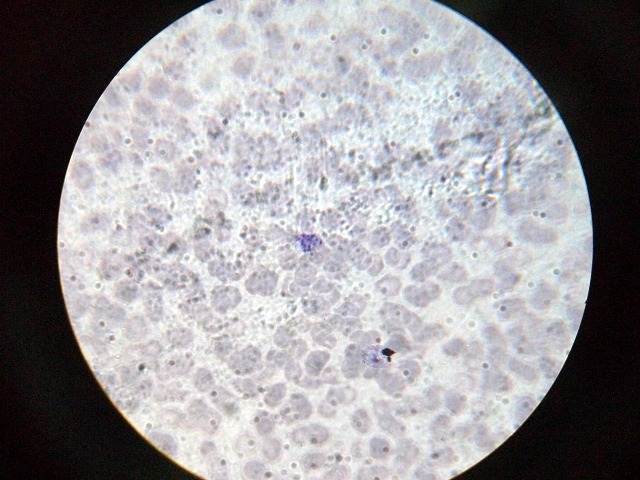 顯微鏡下的瘧原蟲
