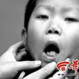 慢性鉛中毒