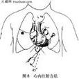 心搏驟停
