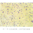 無乳鏈球菌(B組鏈球菌) 無乳鏈球菌(B組鏈球菌)