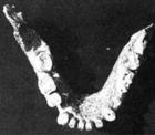 下頜骨化石