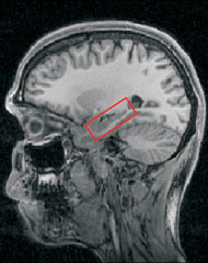 海馬區在人腦中的位置