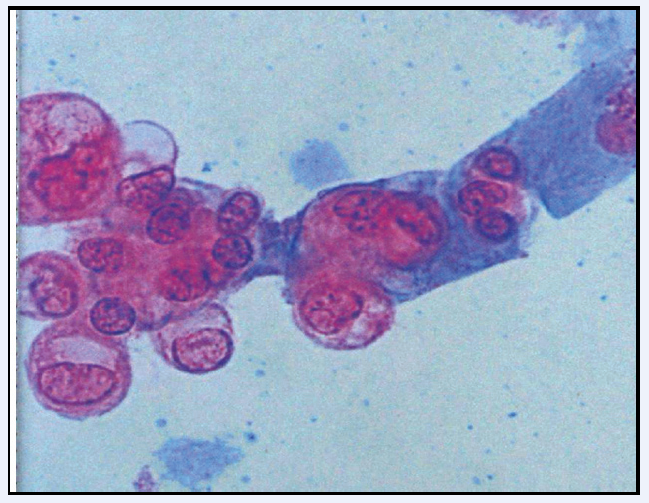 圖4 尿腎小管上皮細胞（S染色）
