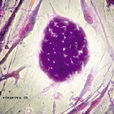 人類卵細胞成功培養胚胎幹細胞
