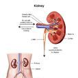 囊性腎癌 囊性腎癌