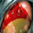 技擊之王 技擊之王