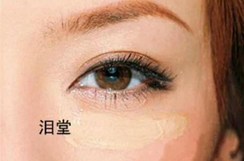 淚堂痣 淚堂痣
