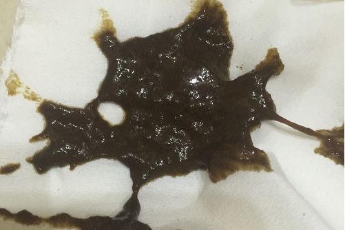 網管球蟲 網管球蟲