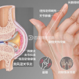 類風濕關節炎(類風濕病)