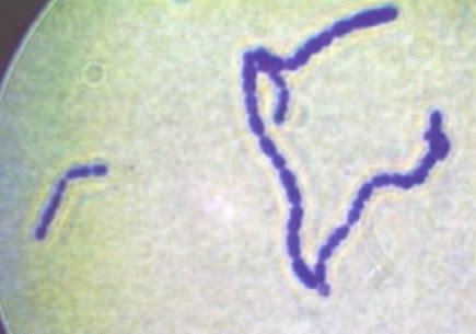 溶血性鏈球菌