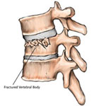 脊椎骨