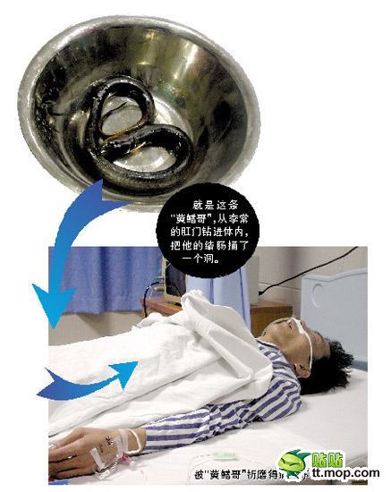 黃鱔哥 黃鱔哥
