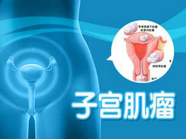 孕期子宮肌瘤