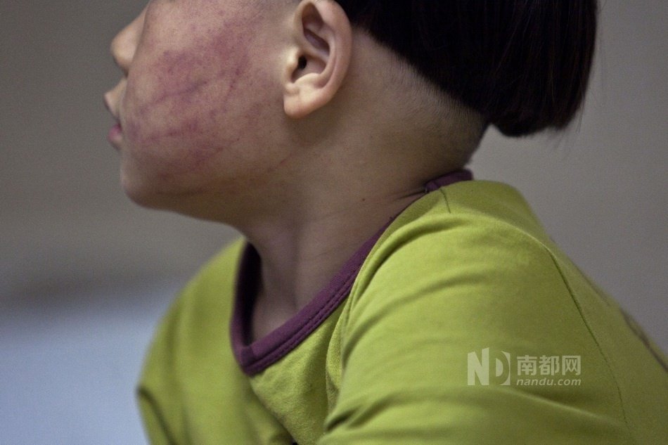 廣州女幼師體罰5歲男童事件