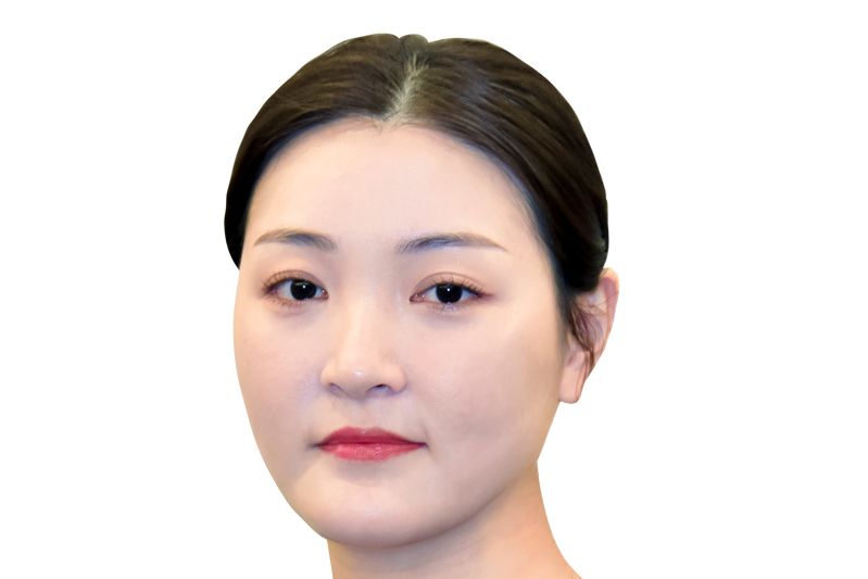 張琪(濟南藝星整形美容醫院執業醫師) 張琪(濟南藝星整形美容醫院執業醫師)