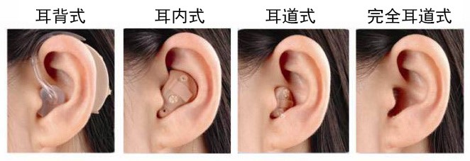 助聽器