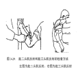 腱反射(深反射) 腱反射(深反射)