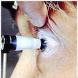 青光眼日 青光眼日