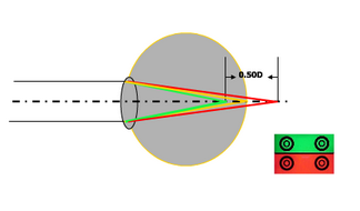 視力正常時紅光、綠光與視網膜的位置關係