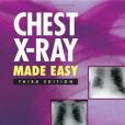 Chest X-Ray Made Easy Chest X-Ray Made Easy