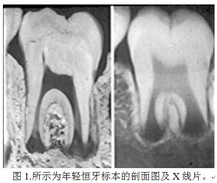 年輕恆牙與成熟恆牙的檢查對比