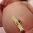 新生兒臍帶的處理