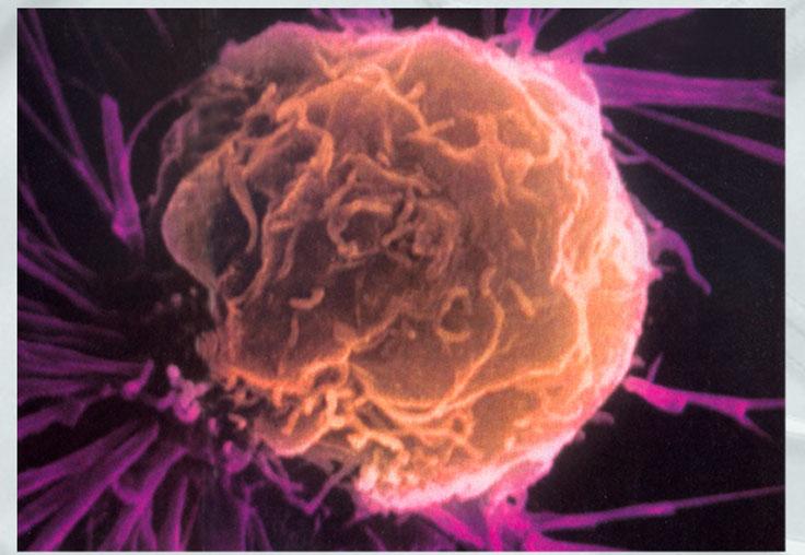 癌細胞繁殖