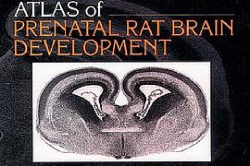 Atlas of Prenatal Rat Brain Development Atlas of Prenatal Rat Brain Development