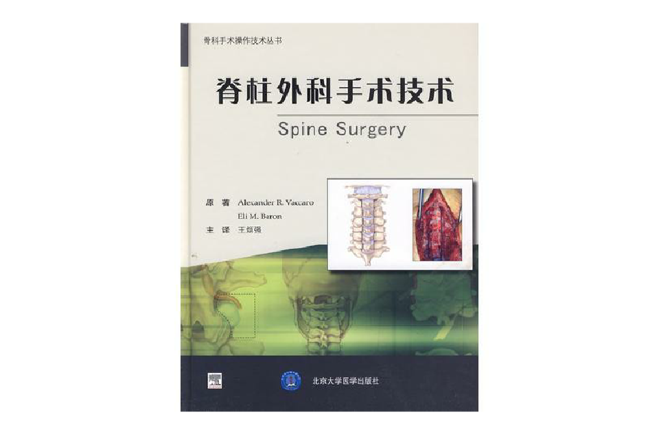 脊柱外科手術技術