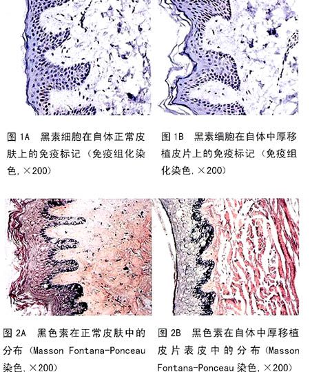 促黑素細胞激素(促黑激素) 促黑素細胞激素(促黑激素)