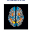 BRAIN RESEARCH BRAIN RESEARCH