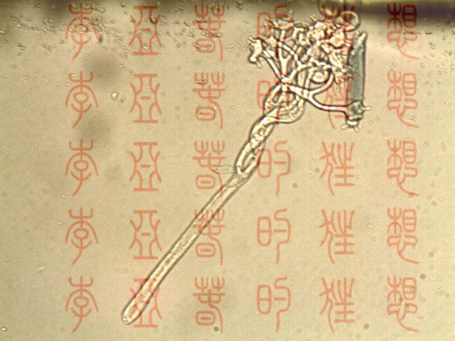 萵苣霜霉 萵苣霜霉