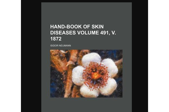 Hand-Book of Skin Diseases Volume 491, V. 1872 Hand-Book of Skin Diseases Volume 491, V. 1872