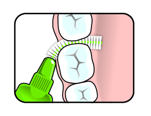 牙間刷