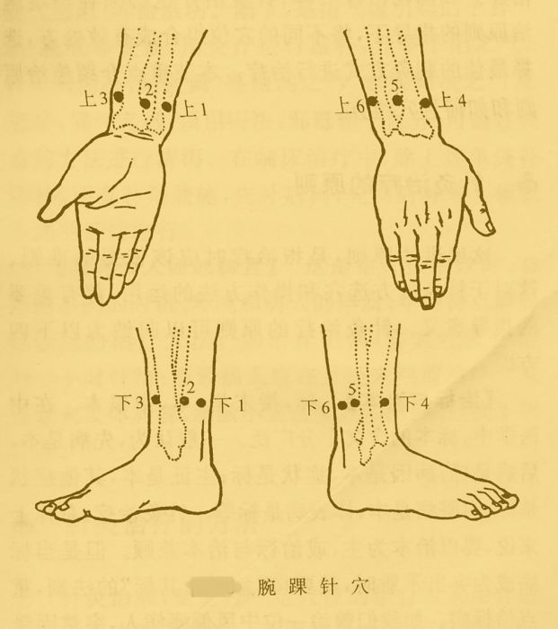 腕踝針法 腕踝針法