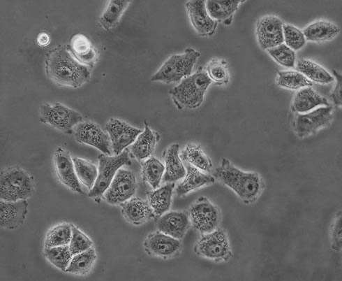 nih3t3 swiss小鼠胚胎成纖維細狀（黑白圖）