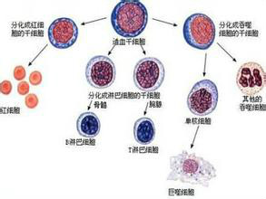 造血祖細胞