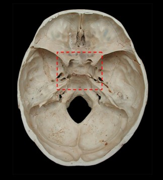蝶鞍區是指顱中窩中央部的蝶鞍及其周圍區域