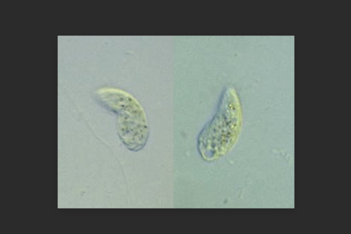 豆腎形蟲 豆腎形蟲